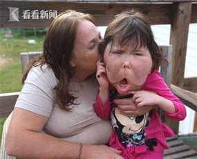 吃瓜少女胖脸视频下载,揭秘网络红人幕后生活